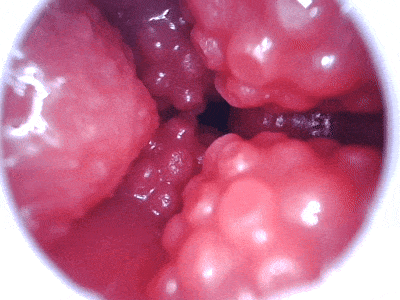 【神器社测评】AGI巨蟹座——轻重量小臀，刺激和温和并存