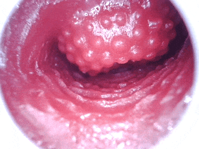 【神器社测评】AGI巨蟹座——轻重量小臀，刺激和温和并存